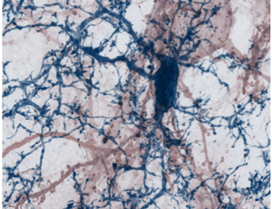 A nerve cell with its dendritic processes studded by synaptic spines (red) being contacted by brain-resident microglia cell (blue) in a mouse brain. Source: Misgeld & Kerschensteiner