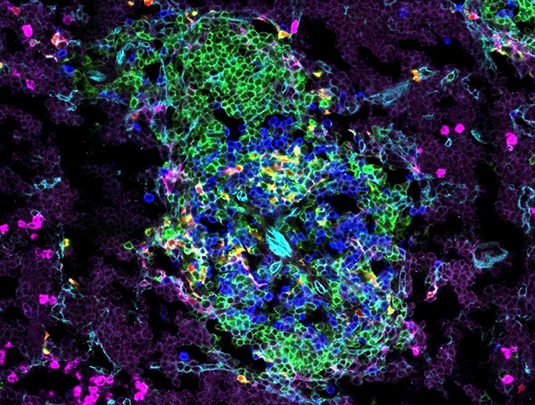 Dendritic cells (red/yellow) and T cells (blue) in the spleen of newborn, 8-day-old mice. Source: Stephan Rambichler